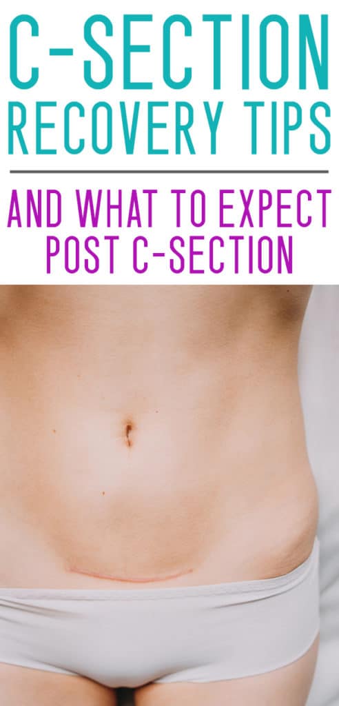 POST C SECTION RECOVERY TIPS