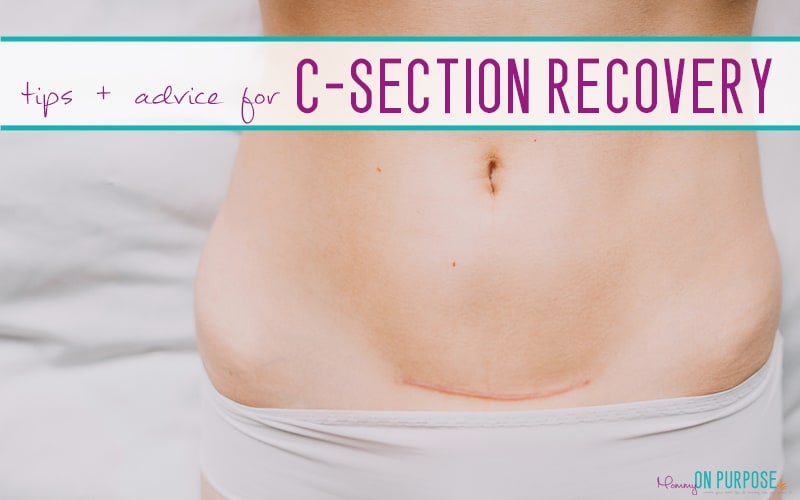 How to Recover from a C-section (as quickly as possible)